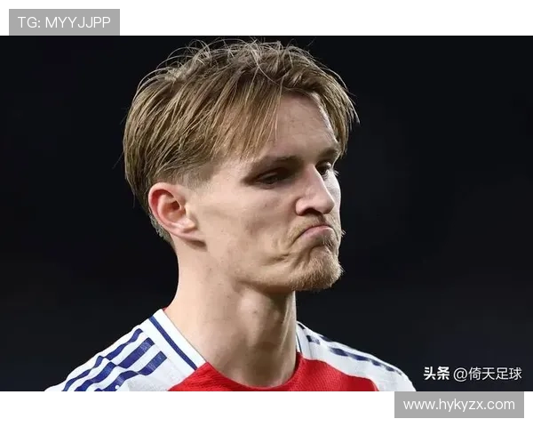 拜仁劲敌居勒伤缺世界杯堪忧